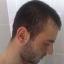 ���������� ������, ���� ������� Noro, 35 ���, ������������ ��� ������