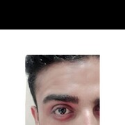  Springvale,  Aryan, 24