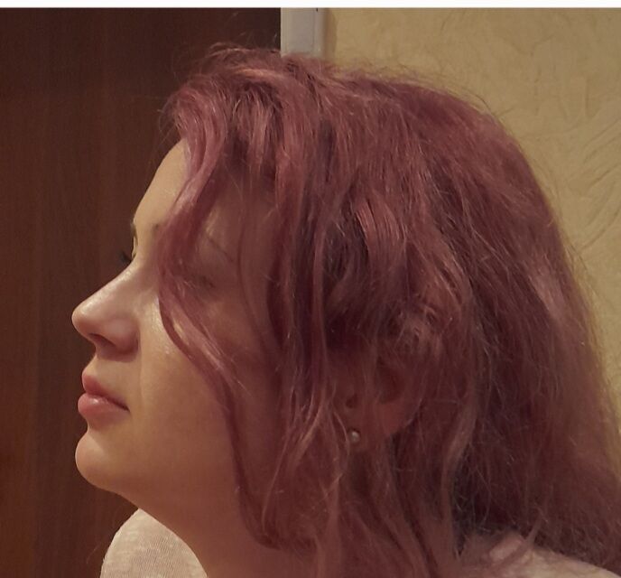  36087885  , 39 ,    