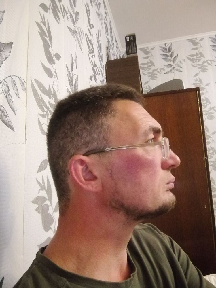  28782225  , 44 ,     