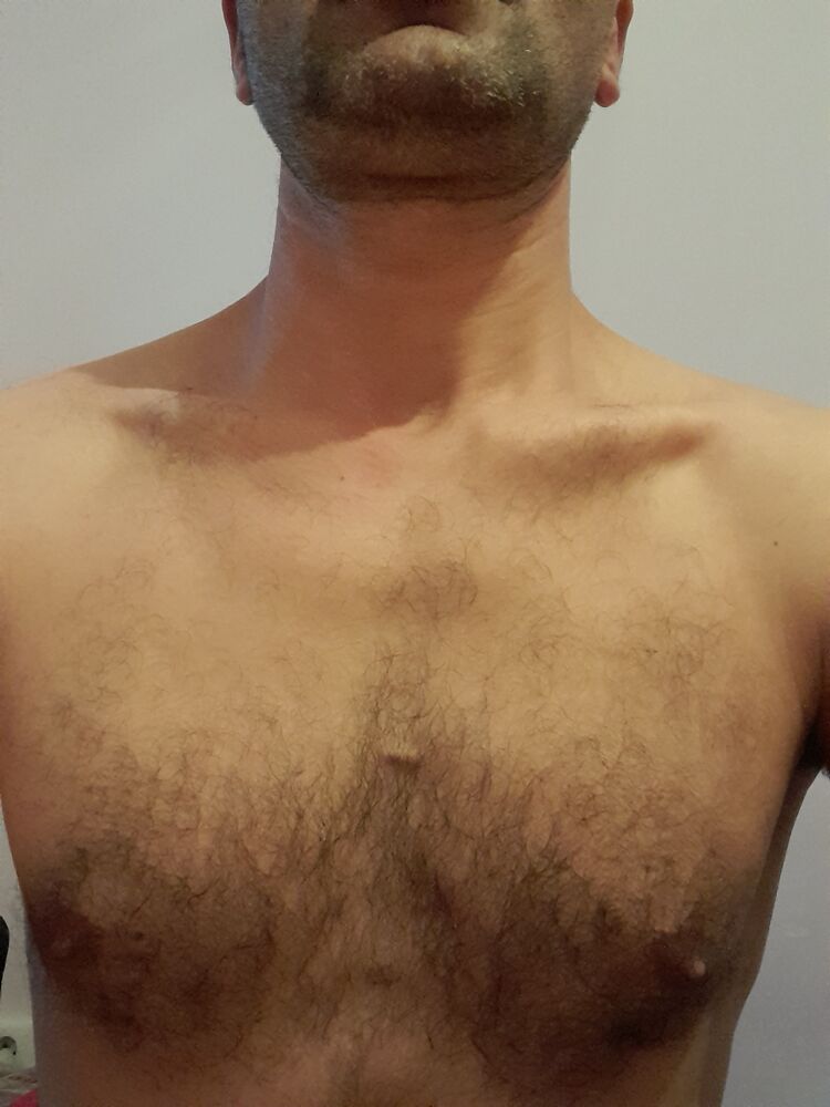  34054385  , 39 ,    