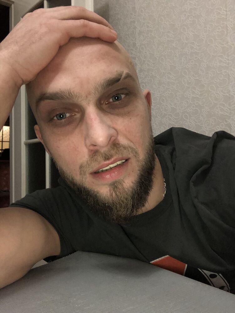 ���� 27042275 ������� �����, 35 ���, ���� ���������� � ������