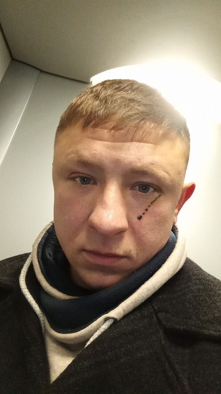 ���������� �����������, ���� ������� ������, 35 ���, ������������ ��� ������, ����� � ���������