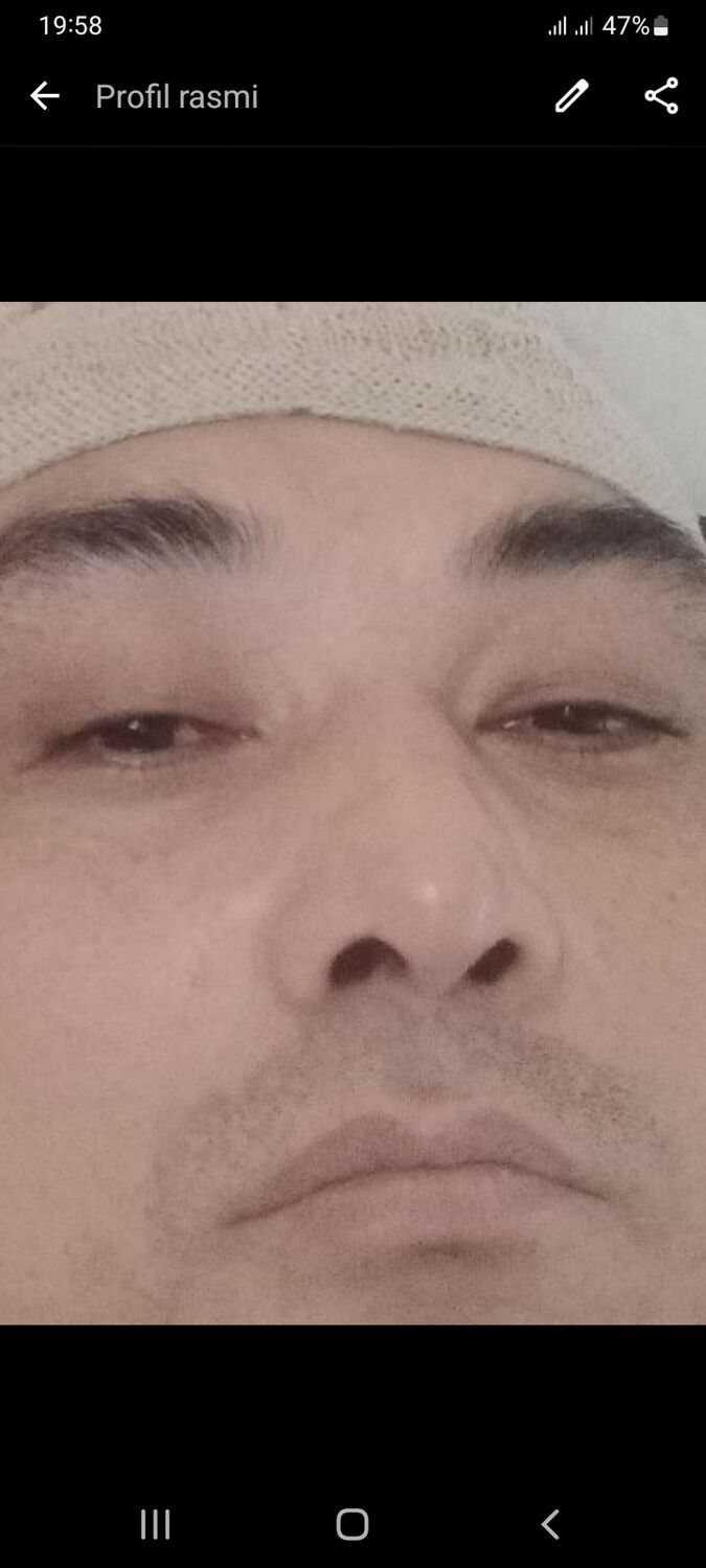  53281515  , 42 ,    