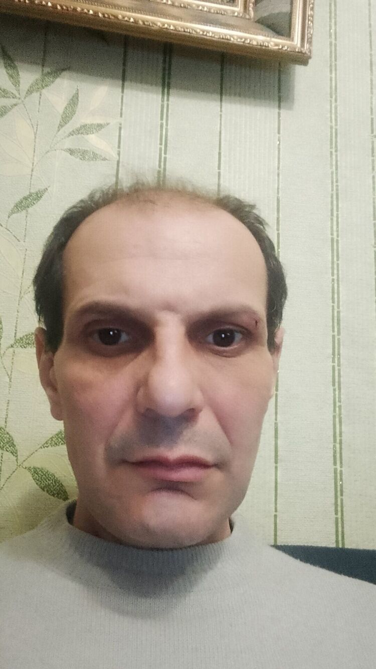 37386615  , 50 ,    