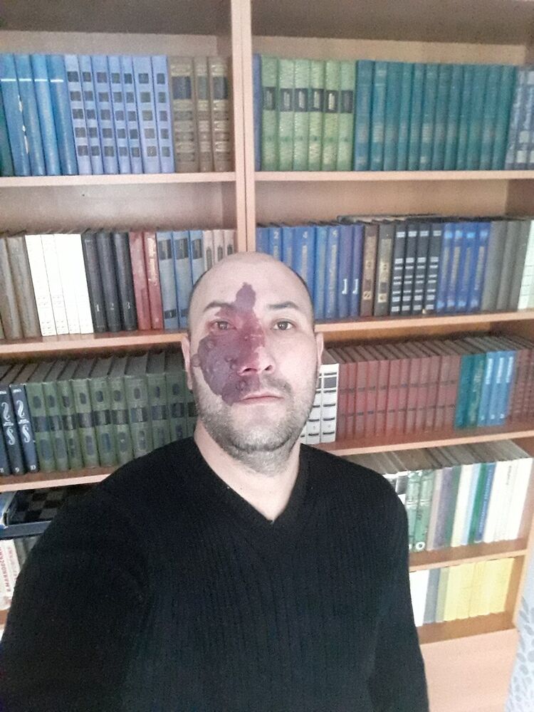 ���������� ����-�����������, ���� ������� ����, 44 ����, ������������ ��� ������, ����� � ���������