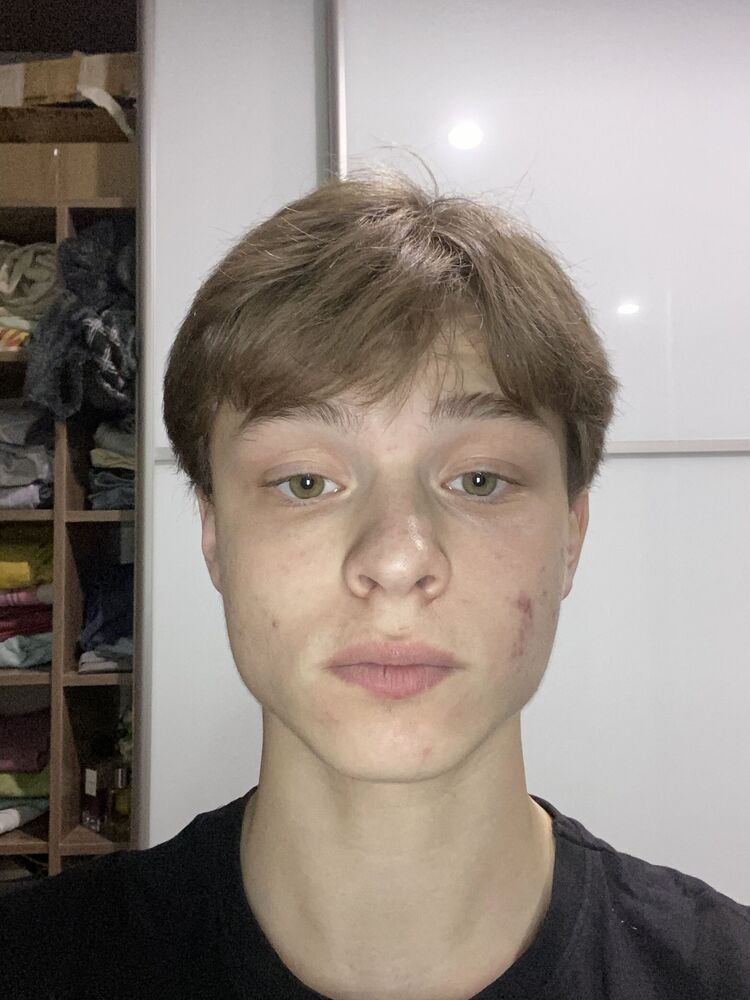  41324255  , 20 ,    