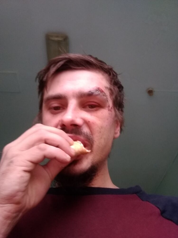  32418695  , 35 ,    