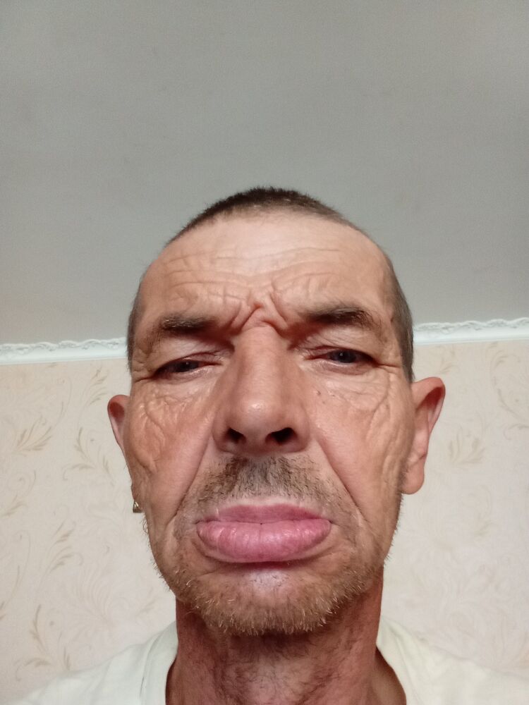 46419465  , 55 ,    
