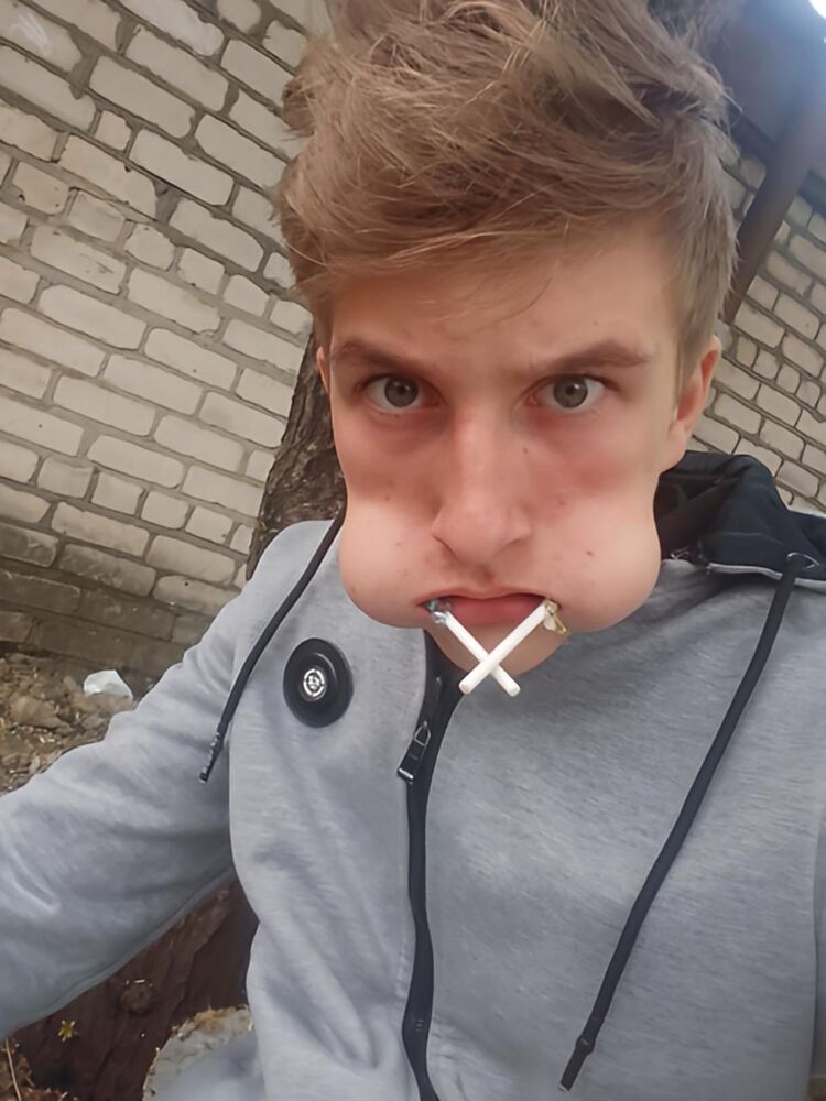  28464175  , 21 ,     