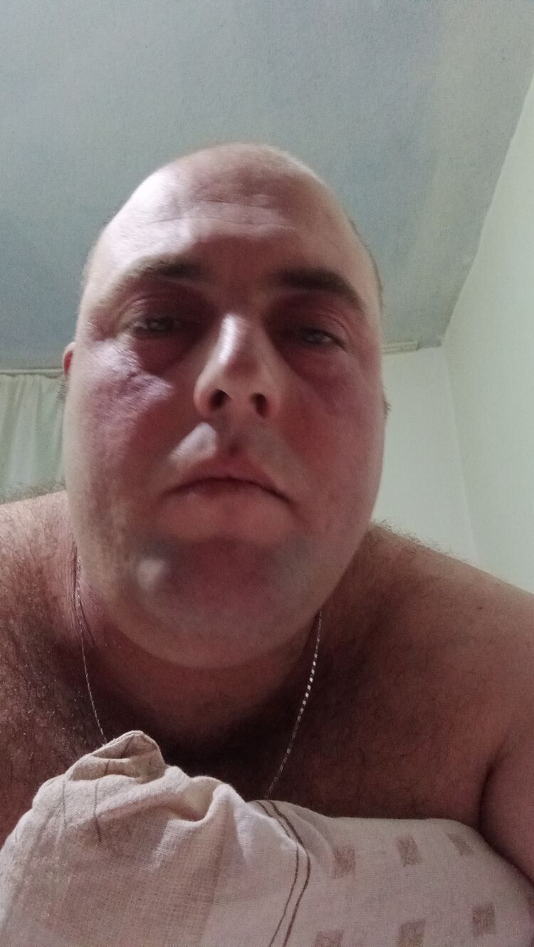  33159715  , 28 ,    