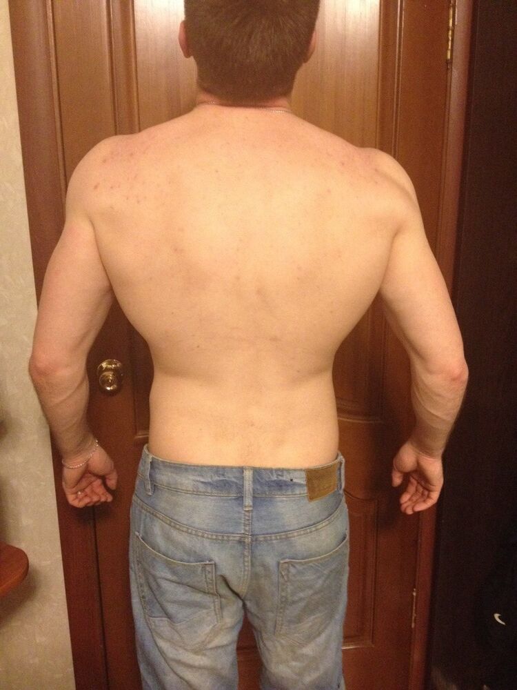  5911715  , 33 ,    