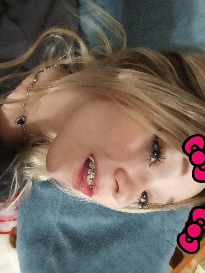  40635845  Aliaswwqz, 19 ,    