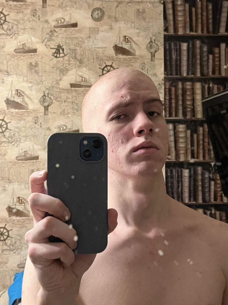  ,   Ը, 18 ,   ,   