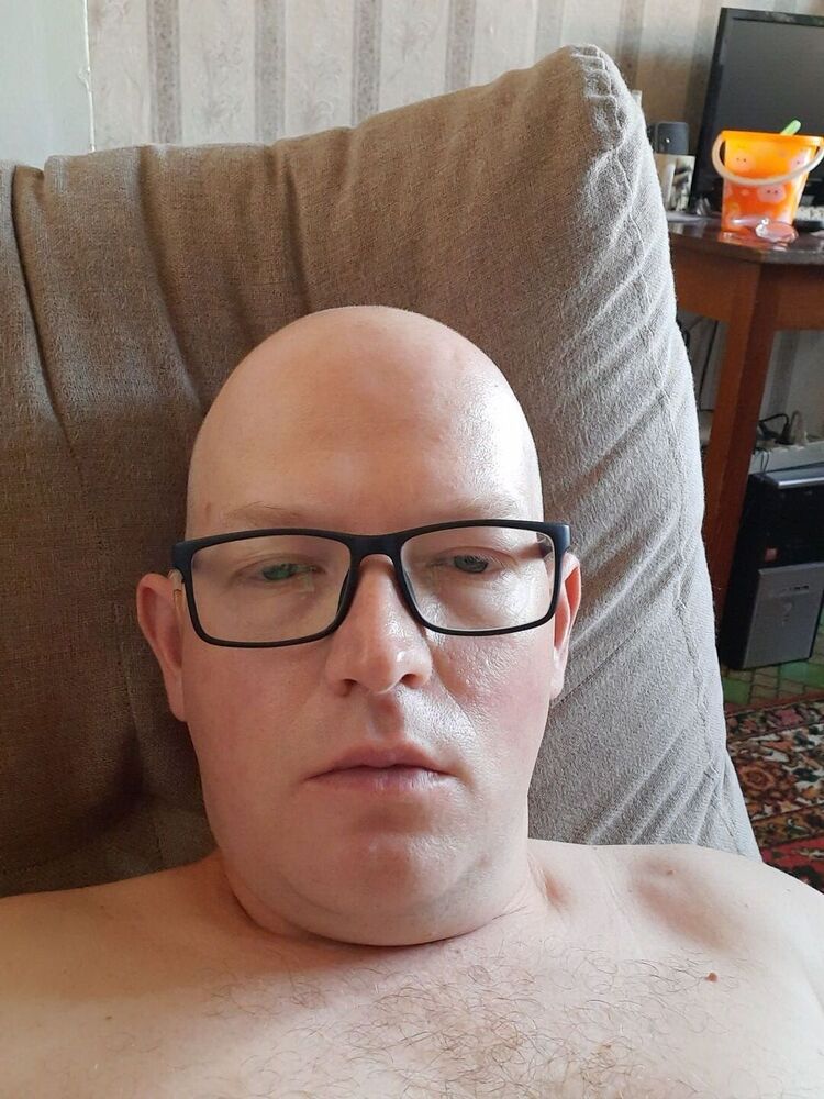  44604615  , 43 ,    
