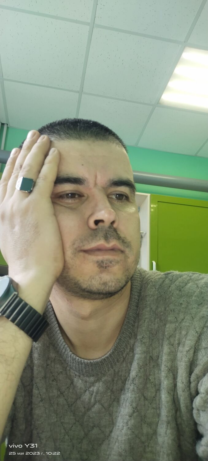  34925275  , 37 ,    --