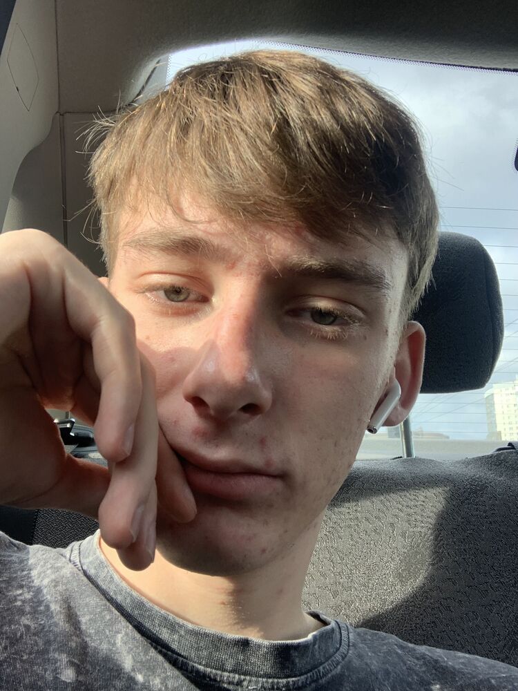  32854995  , 20 ,    -