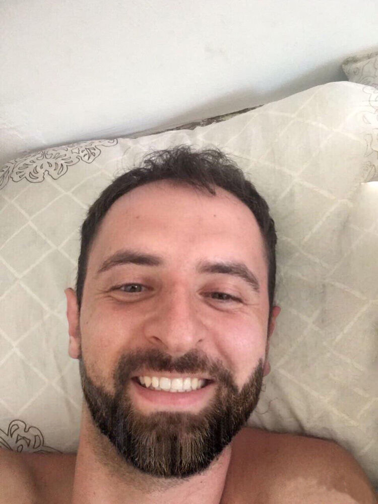  32267415  , 33 ,    
