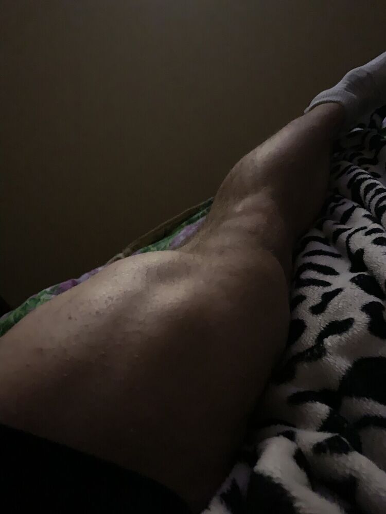  22410845  , 32 ,    