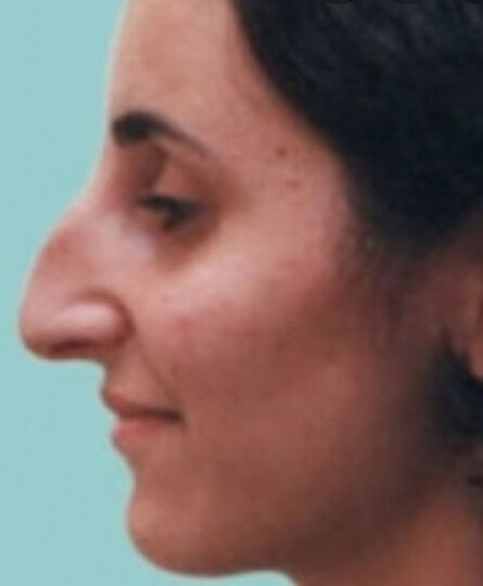 ���������� �����-���������, ���� ������� ������, 46 ���, ������������ 