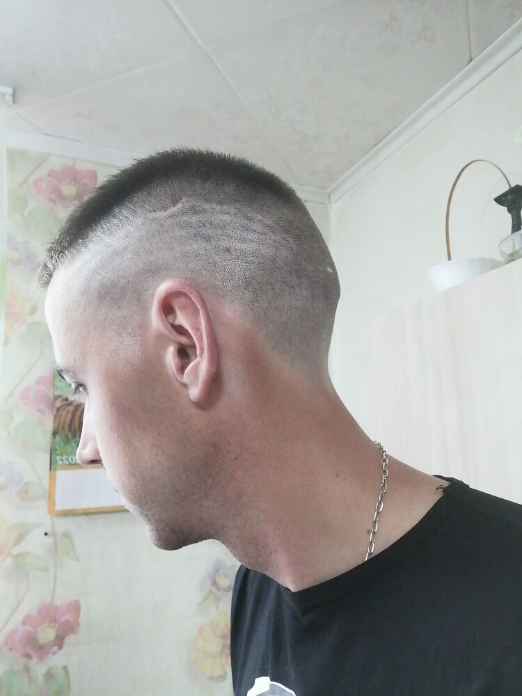  28158825  , 33 ,    