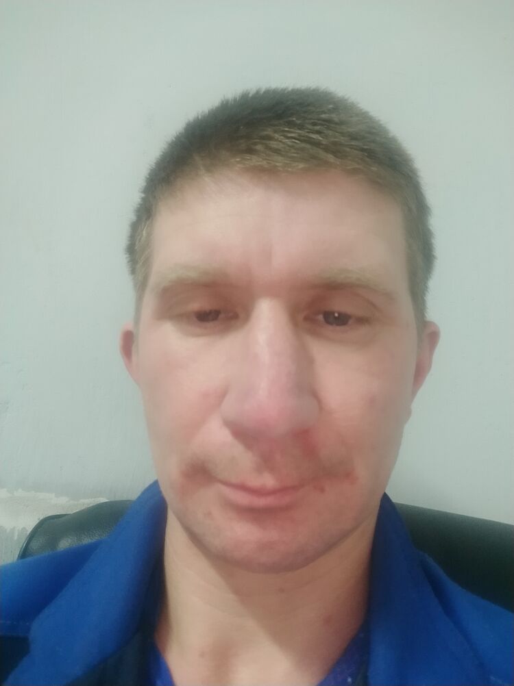  31998775  Anton, 43 ,    