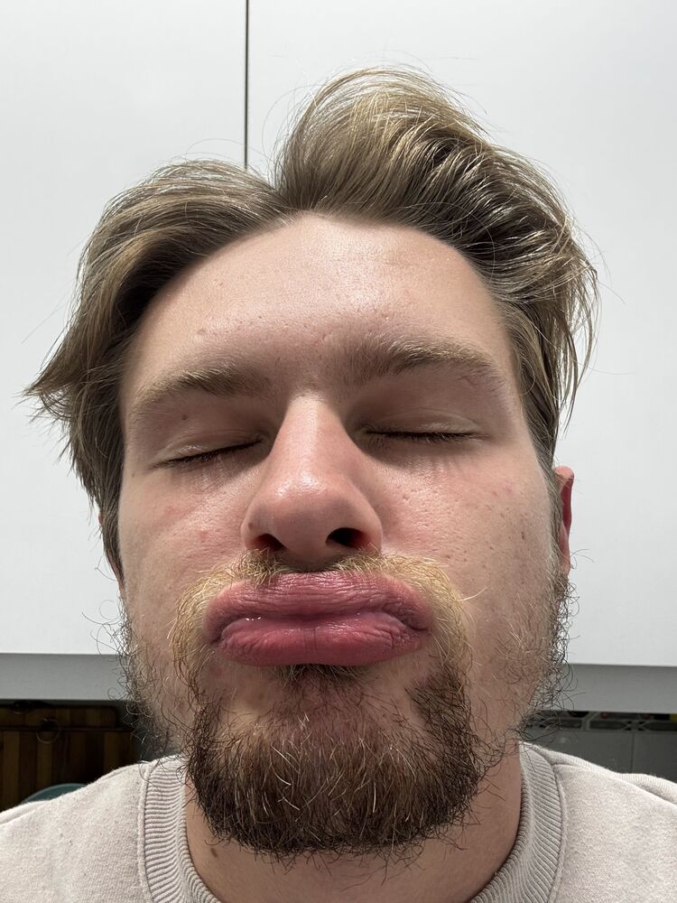 ���� 55913905 ����� �����, 25 ���, ���� ���������� � Chitila