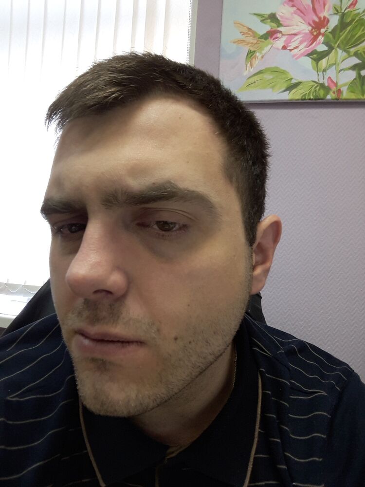  -,   , 35 ,   ,   