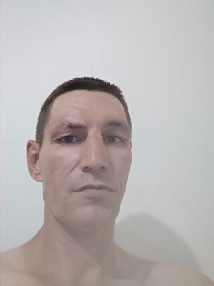  27409665  , 45 ,    --