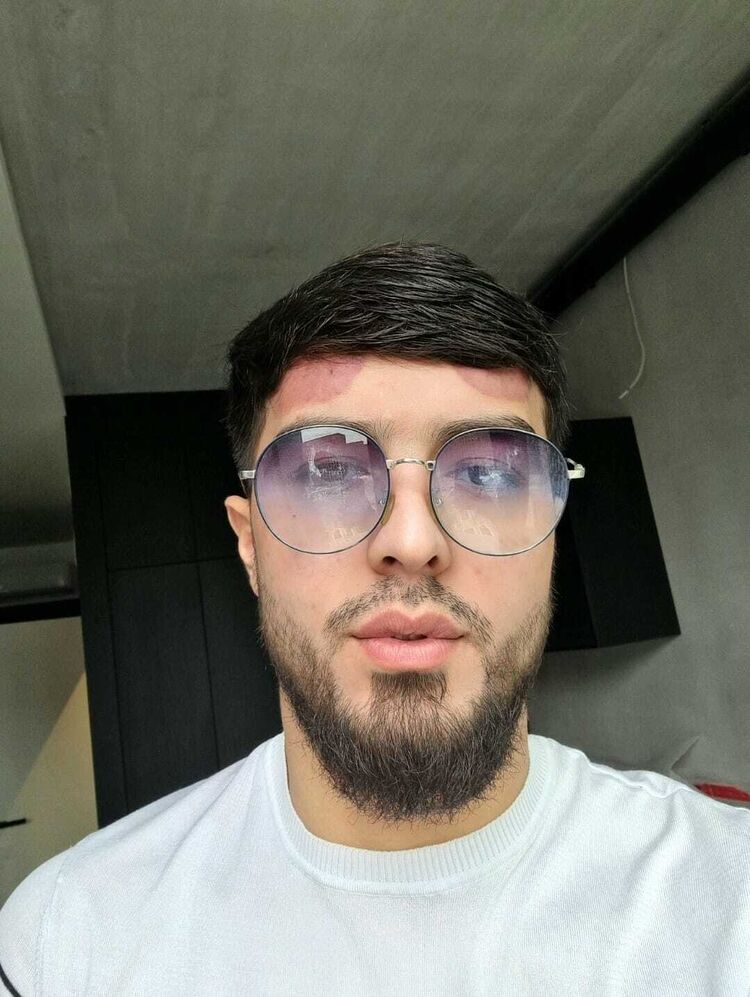  ,   Zaur, 24 ,     , c 