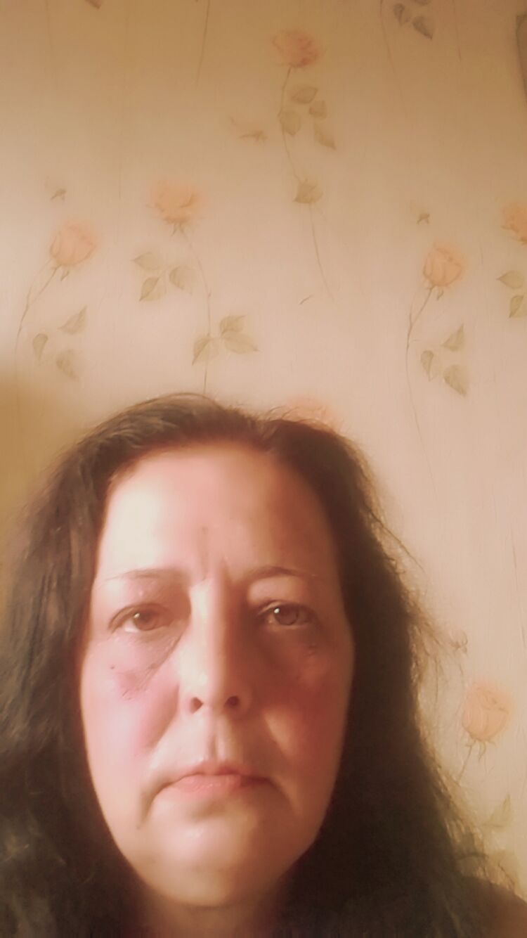  36559655  , 51 ,    