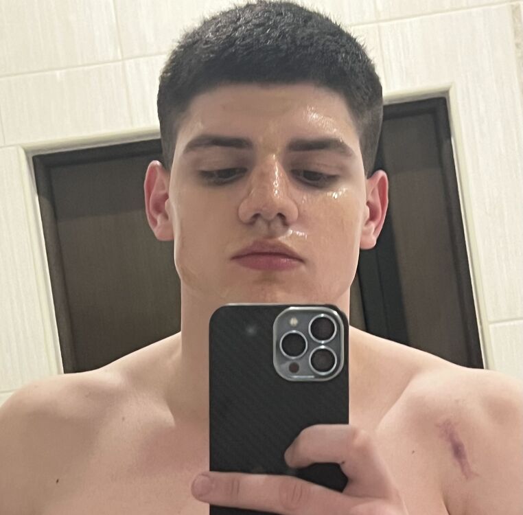  34606485  , 22 ,    --