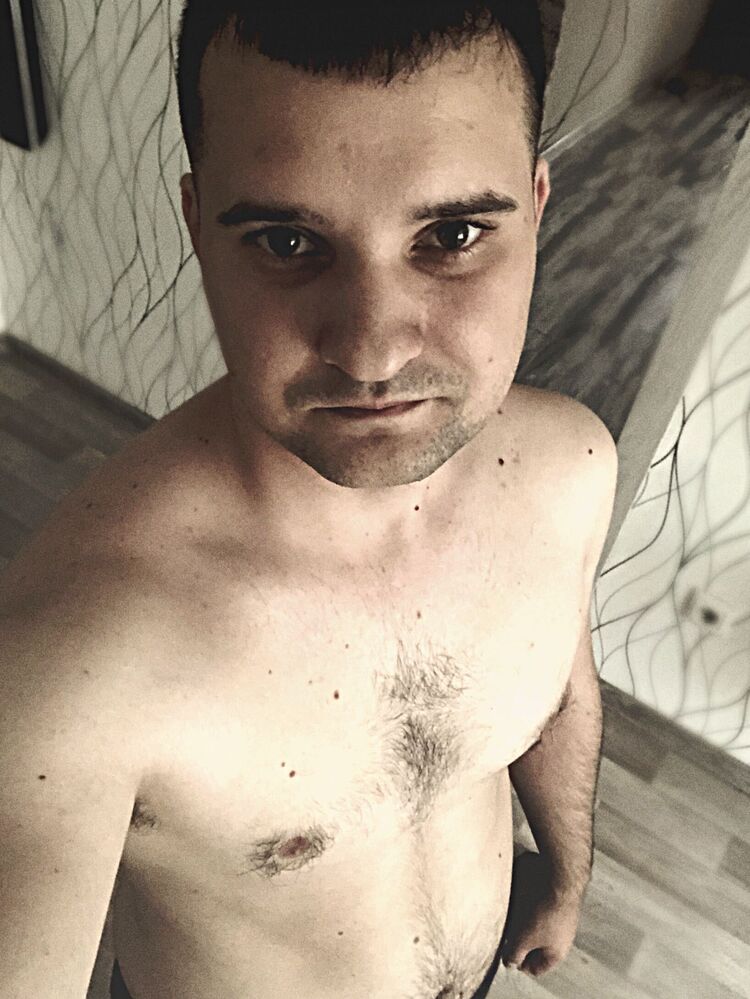  36116565  , 29 ,    