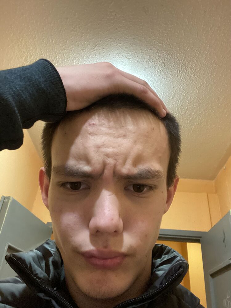  42670355  , 25 ,    