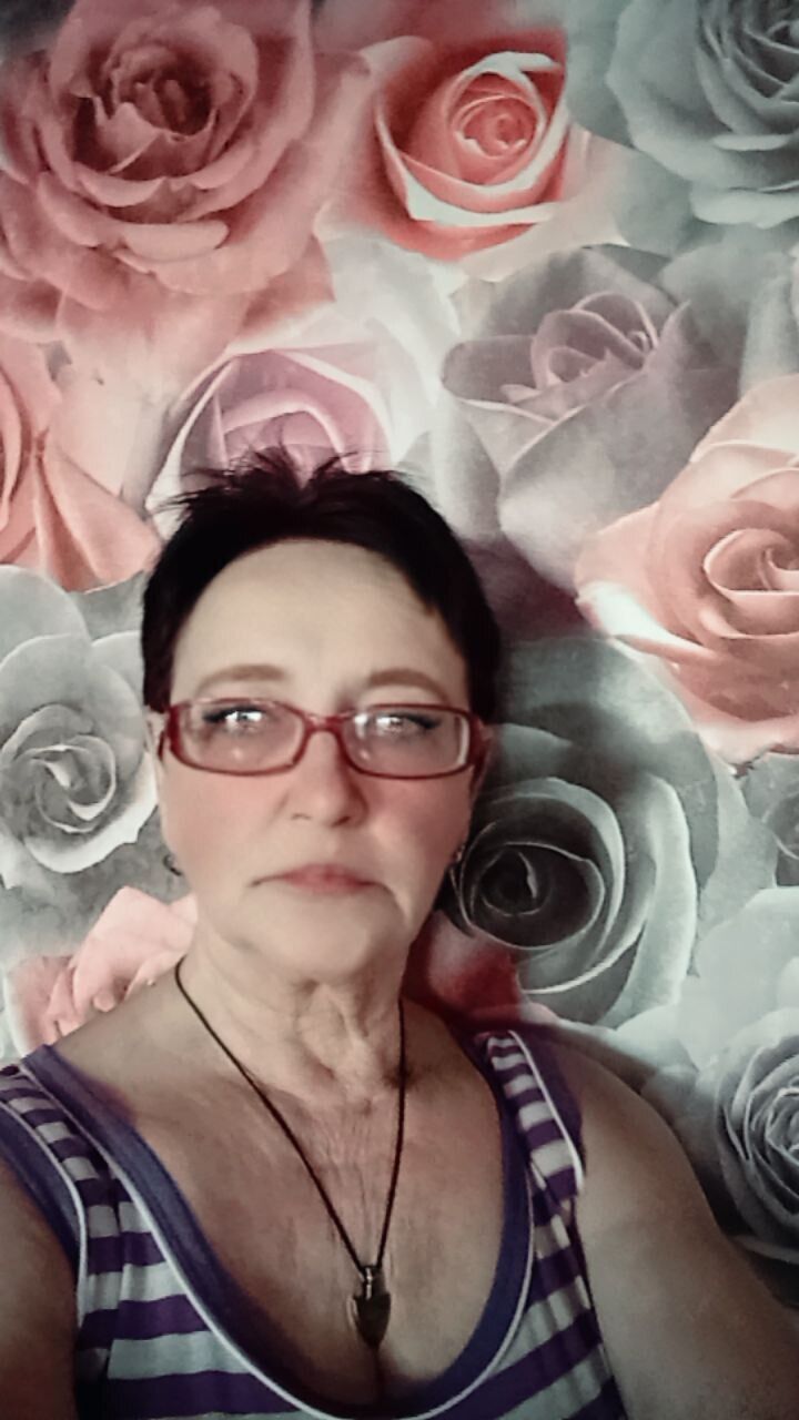  31513145  Keslenka, 65 ,     