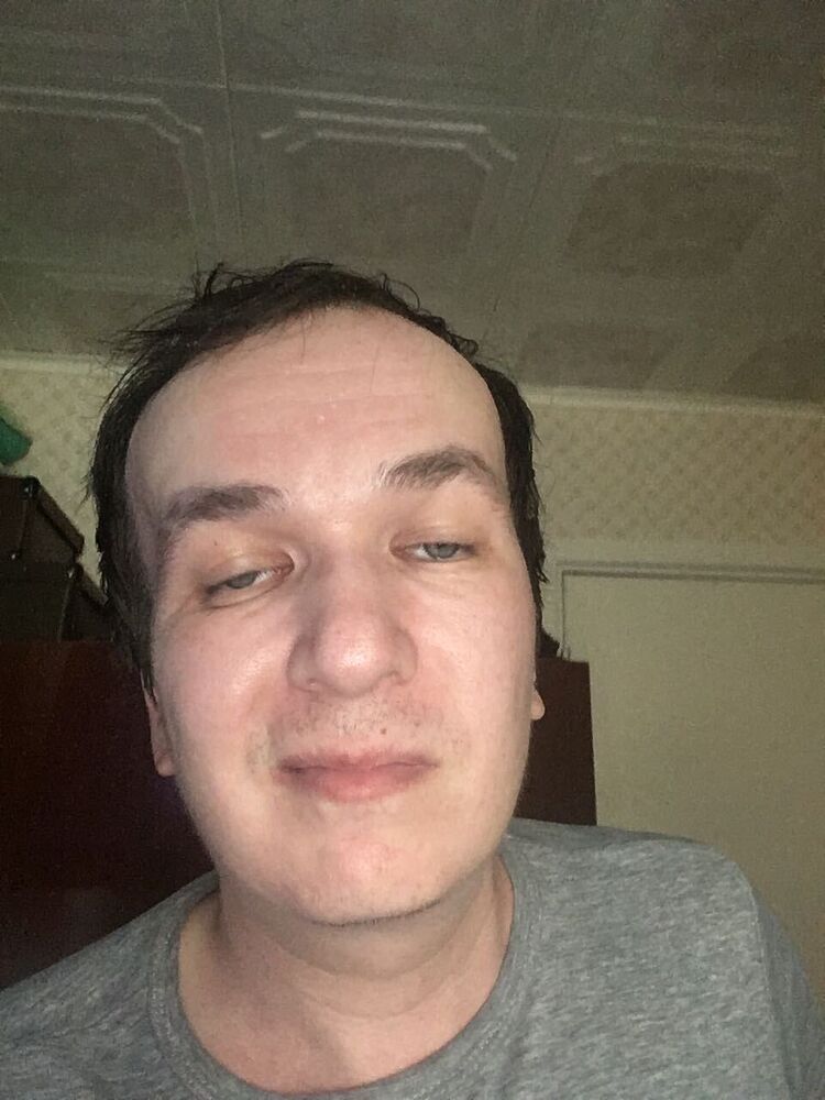  34737765  , 41 ,    