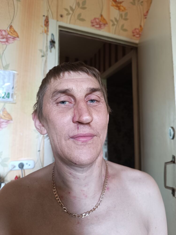  44729225  , 48 ,    