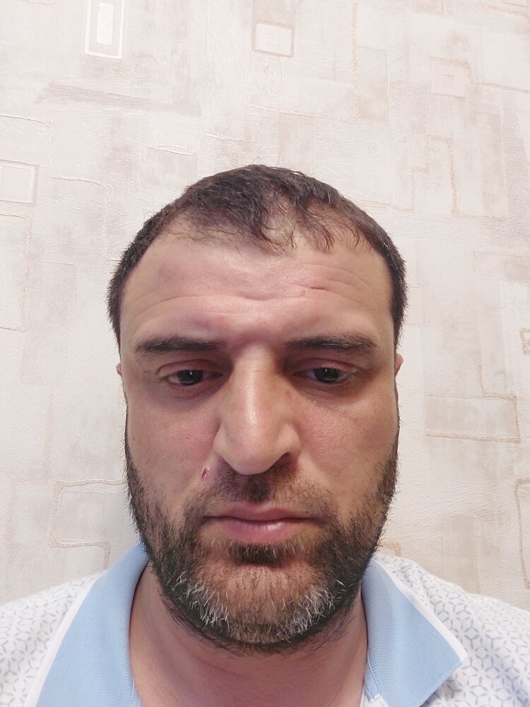  26342315  , 39 ,    