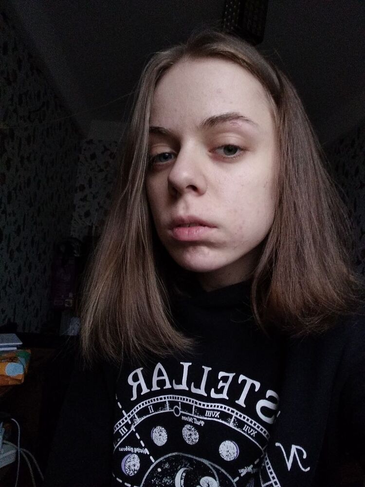  33818645  , 24 ,    -