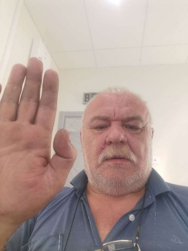  53015615  , 57 ,    