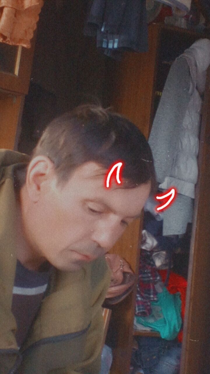  33916595  , 44 ,    