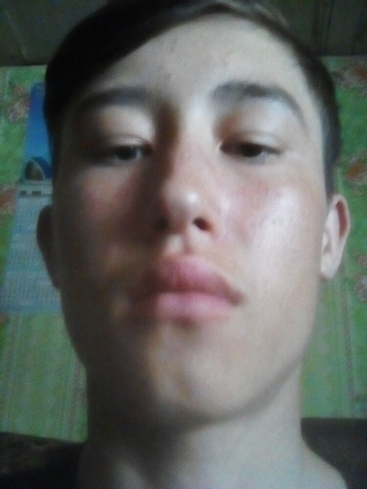  15794935  , 24 ,    