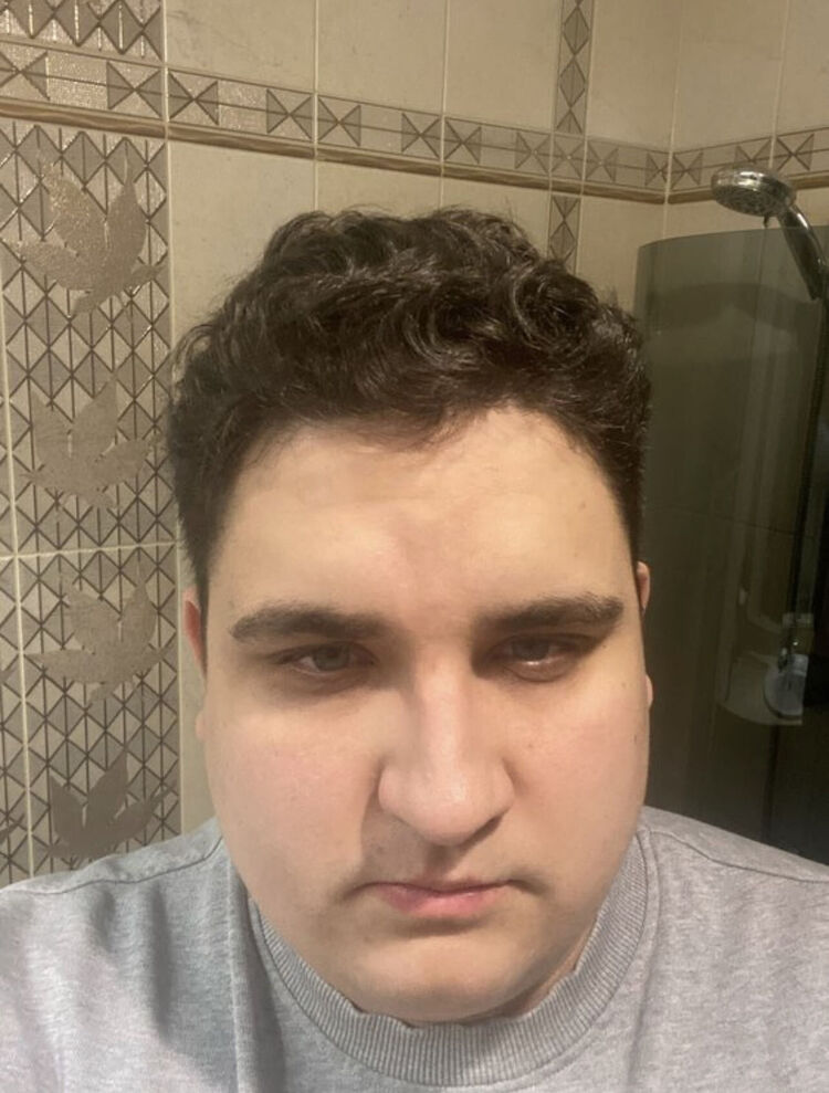  35333205  , 29 ,    -