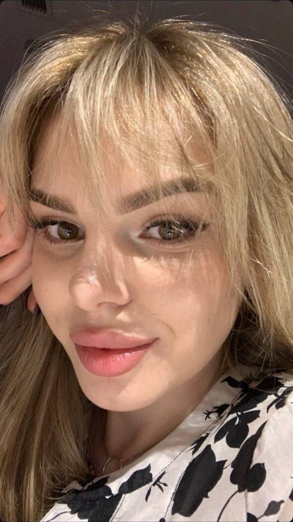  54644355  , 28 ,    -