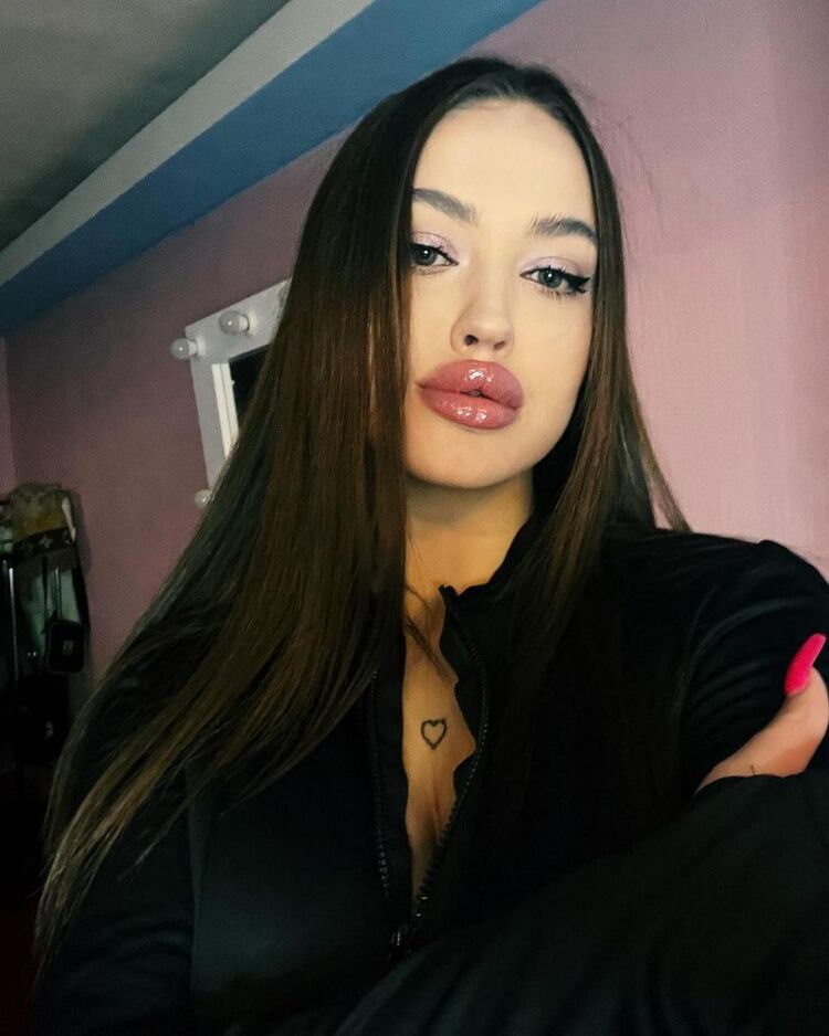  37664695  , 22 ,    -