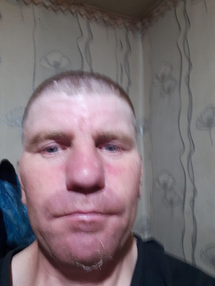  29497405  , 38 ,    