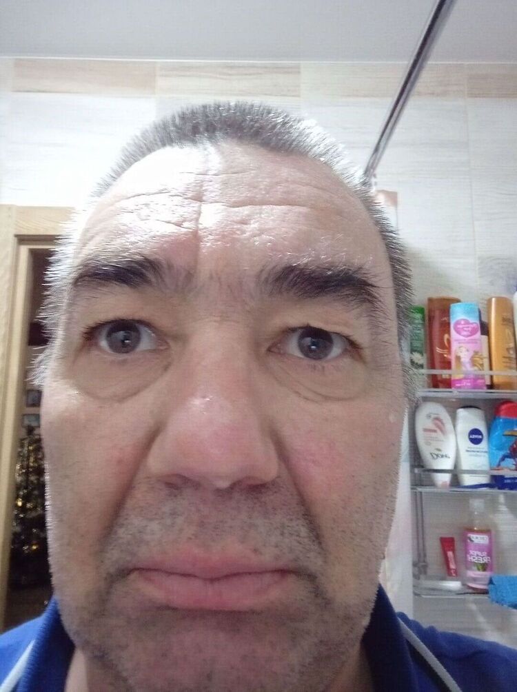  34722965  , 58 ,    