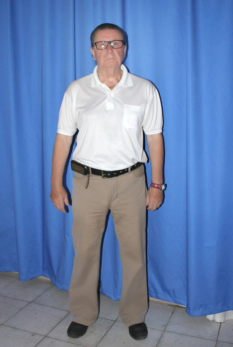  ,    55, 66 ,   