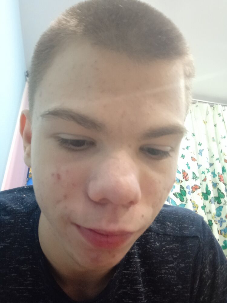  41648335  , 19 ,    